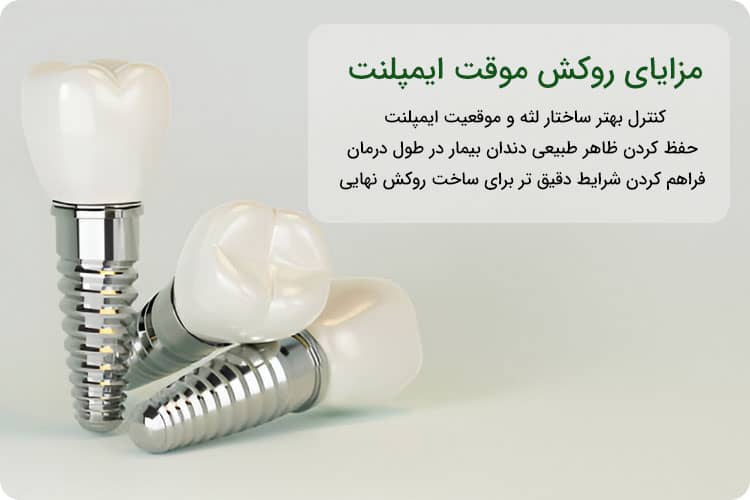 روکش موقت ایمپلنت در مرکز تخصصی مجهز